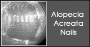 Alopecia Acreata Nails