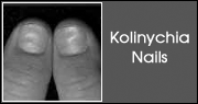 Kolinychia Nails