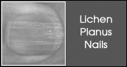 Lichen Planus Nails