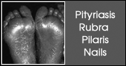 Pityriasis Rubra Pilaris Nails