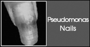 Pseudomonas Nails