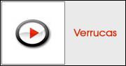 Verrucas